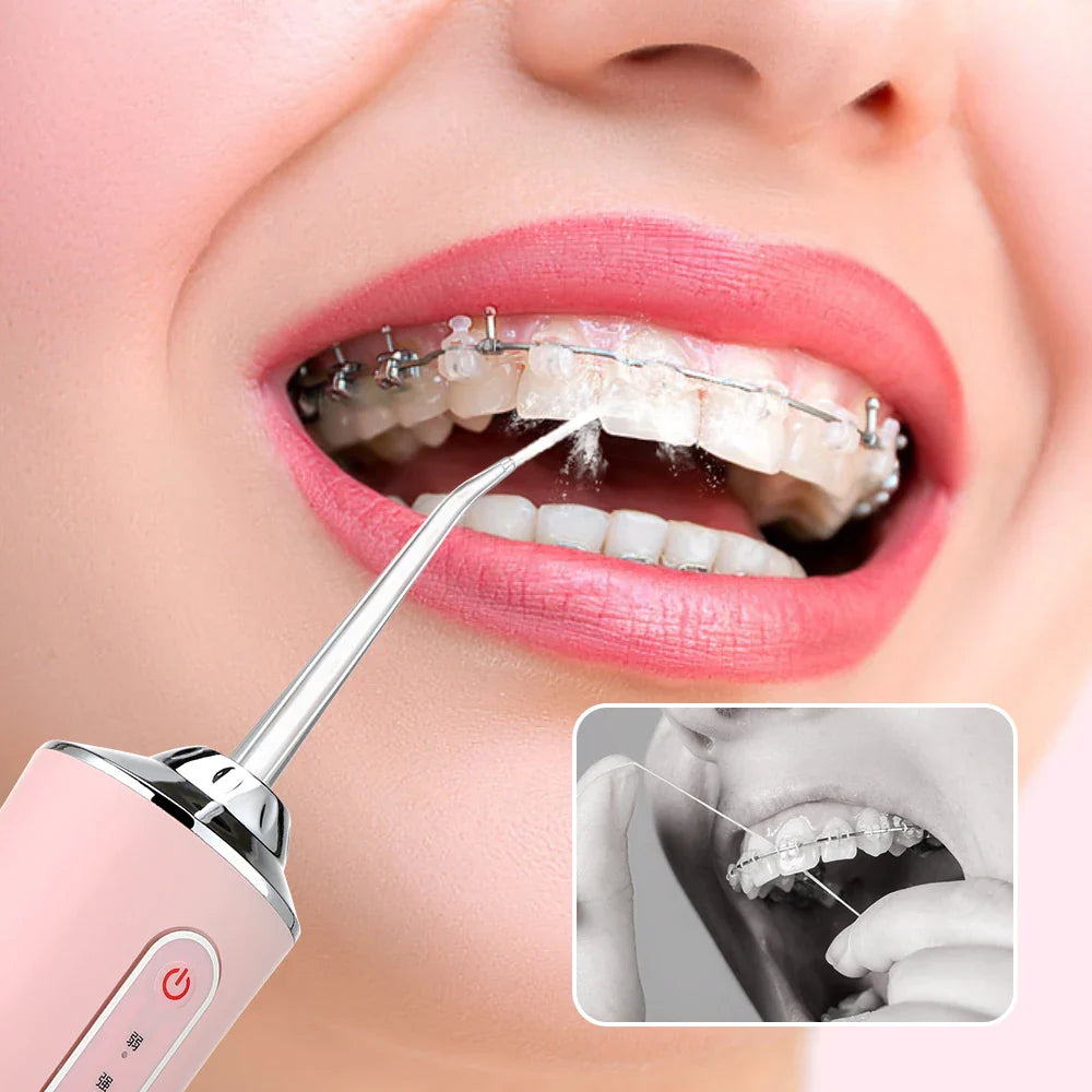 SmartDental Water Flosser